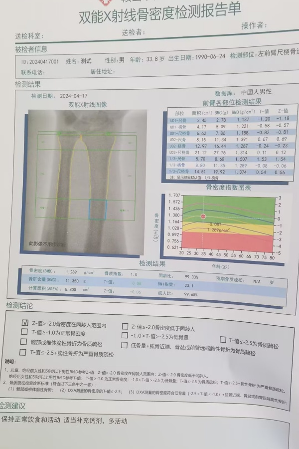 雙能X射線骨密度儀：準(zhǔn)確測量骨密度，助力骨質(zhì)疏松防治，守護(hù)骨骼健康
